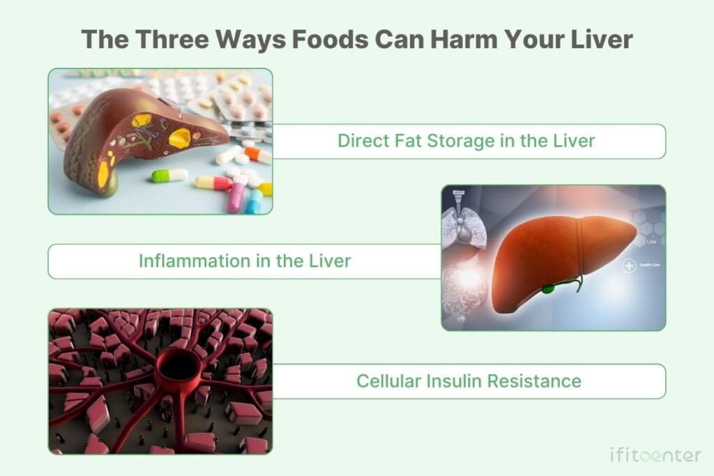 fatty liver foods to avoid