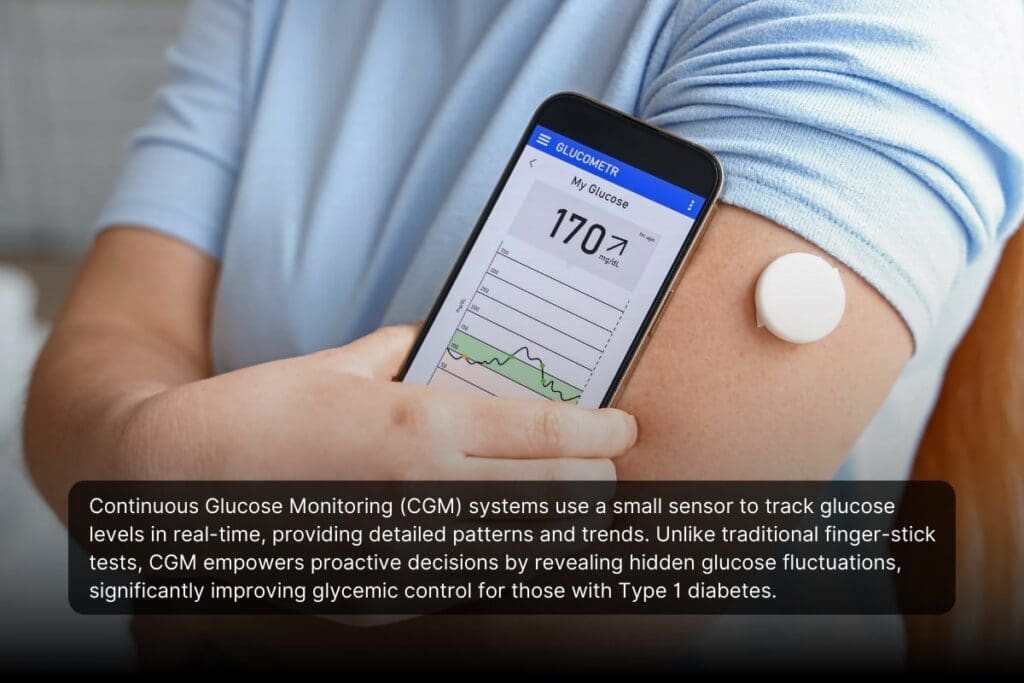 cgm for managing diabetes